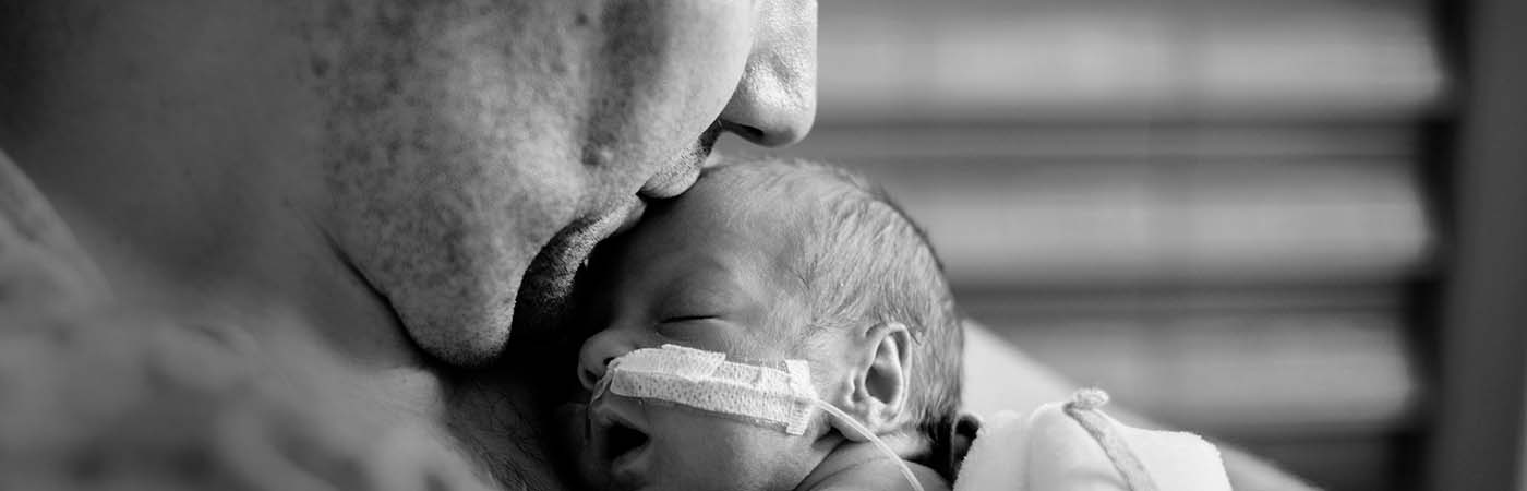 Papá le da un beso en la frente a su bebé prematuro
